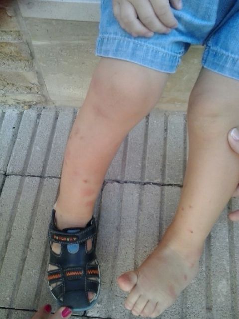 El PSOE exige al Ayuntamiento de Murcia que tome las medidas necesarias para acabar con la plaga de mosquitos