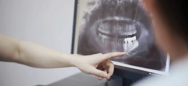 La diabetes también influye en la ortodoncia: investigadores de la UMU a analizan los retos clínicos en pacientes diabéticos