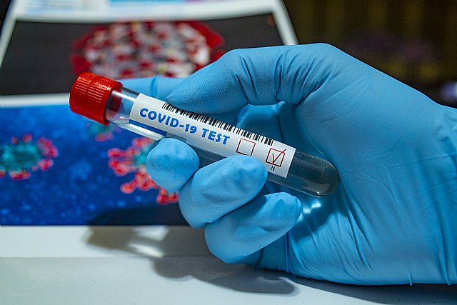 696 casos confirmados de infección por coronavirus COVID-19 en Murcia