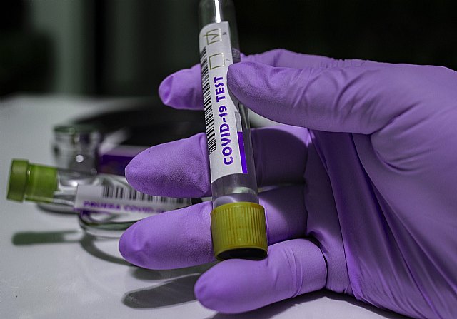 El Ayuntamiento mantiene activado el protocolo sanitario tras la detección de tres positivos de coronavirus en la Escuela Infantil La Ermita de La Alberca